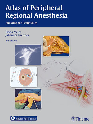 cover image of Atlas of Peripheral Regional Anesthesia